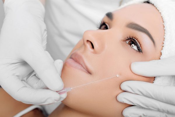 Thread-Lift-Treatment (1)