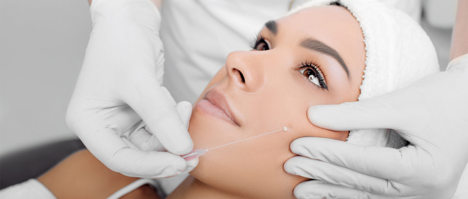 Thread-Lift-Treatment (1)