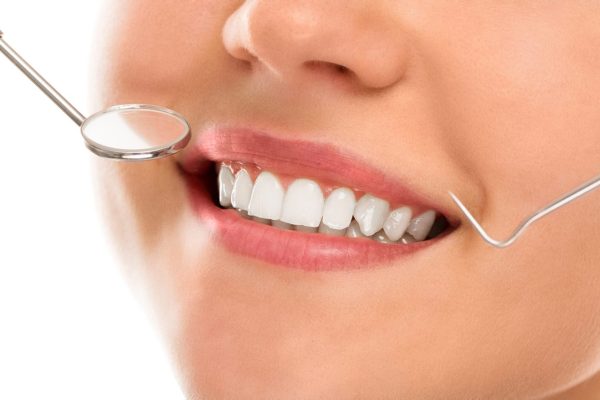 smile makeover