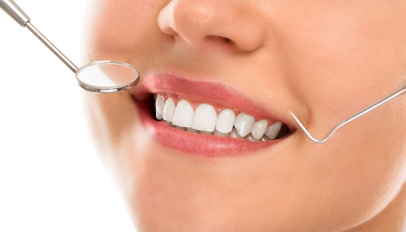 smile makeover