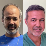 FUE Method: A Modern Solution to Hair Loss
