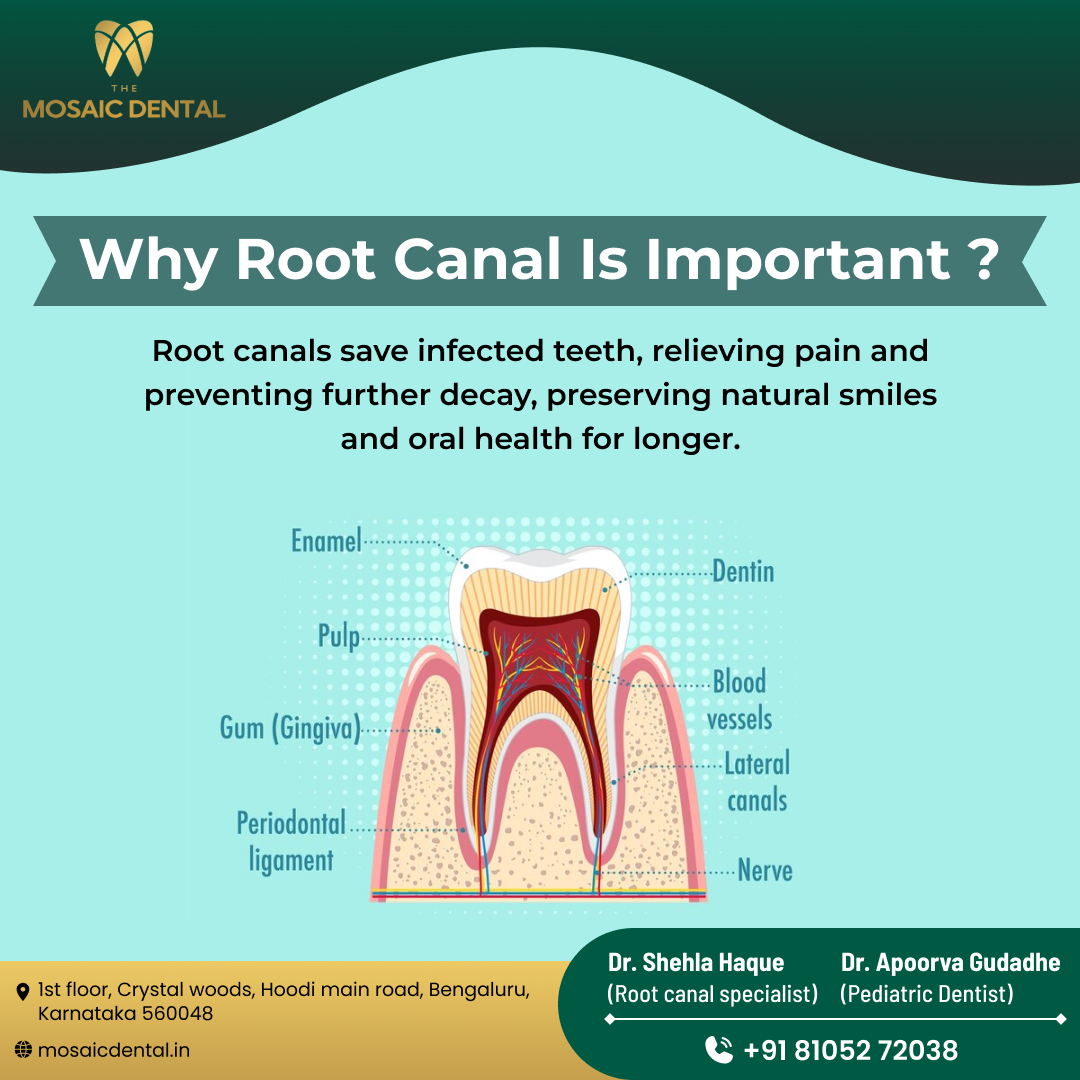 root canal treatment